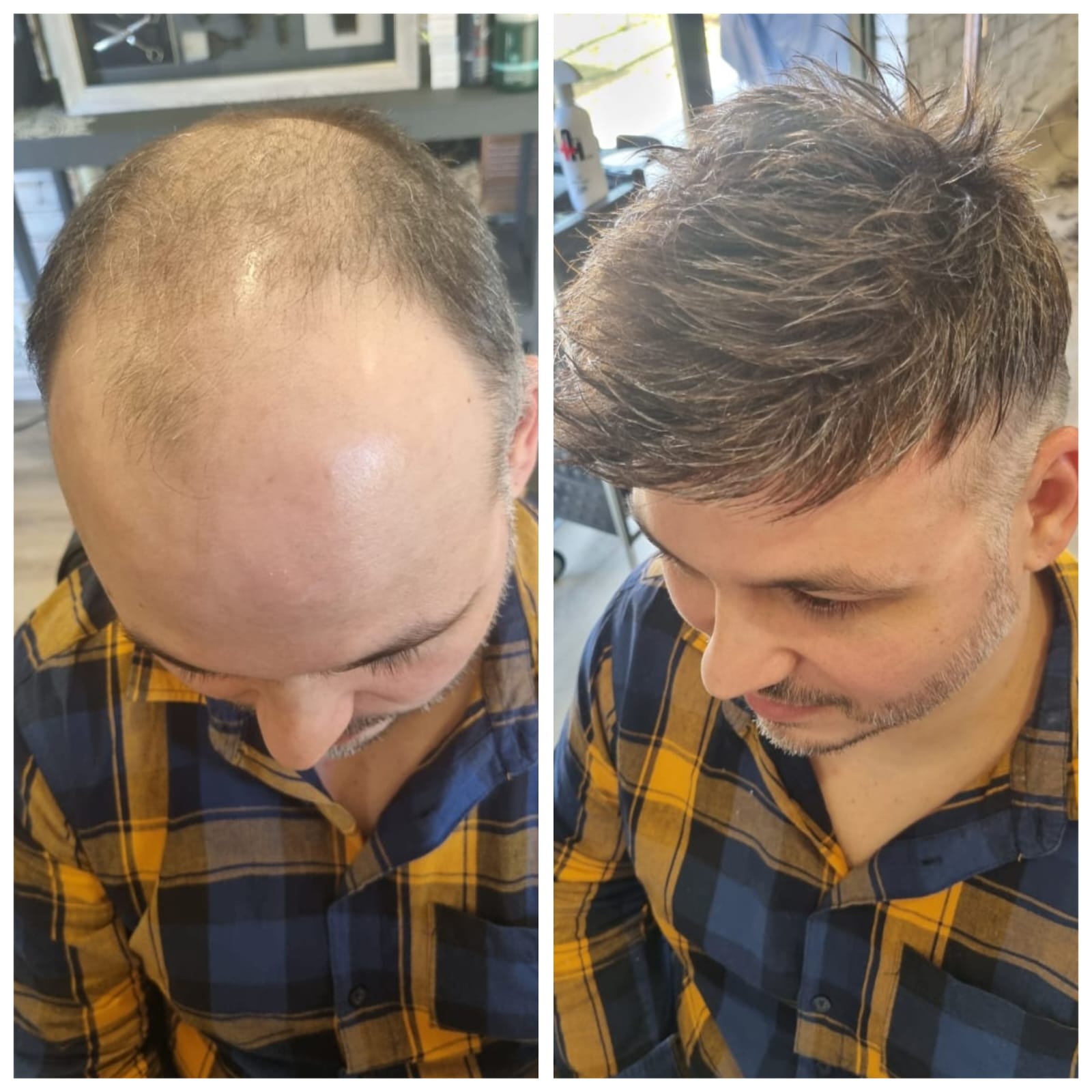 Signature Hair transformation detail