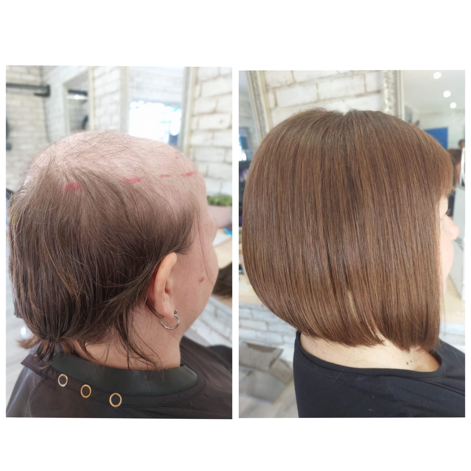 Signature Hair before and after result 4