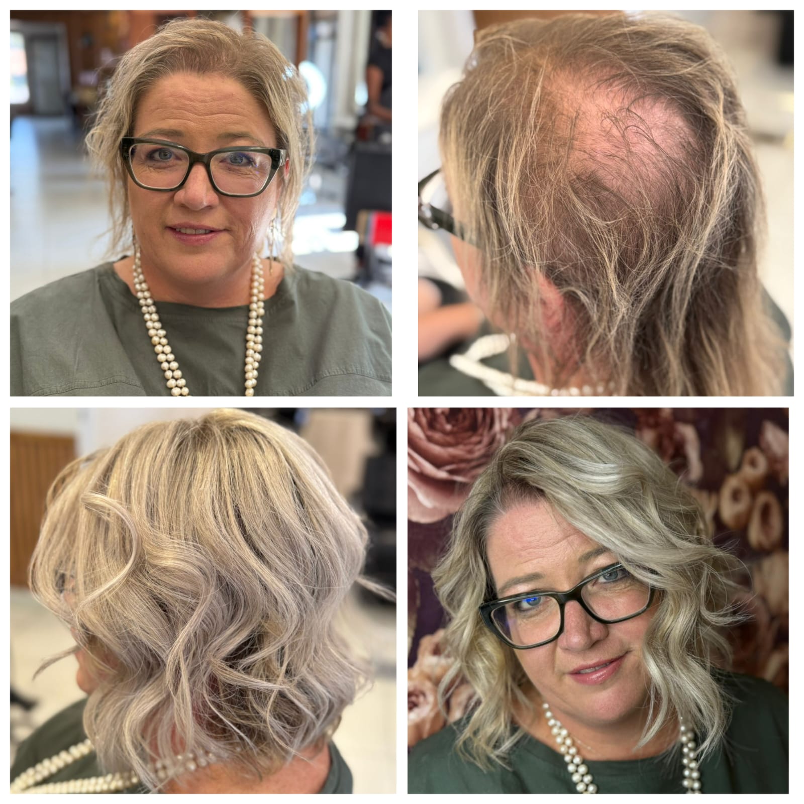 Signature Hair before and after result 5